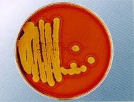 溶血性Bacillus菌
